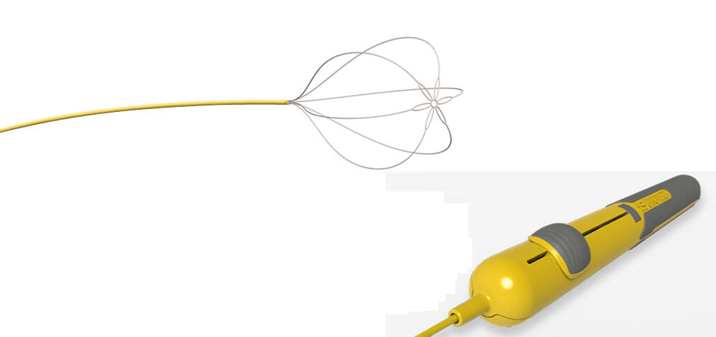 Helical,Basket,Stone,Retrieval