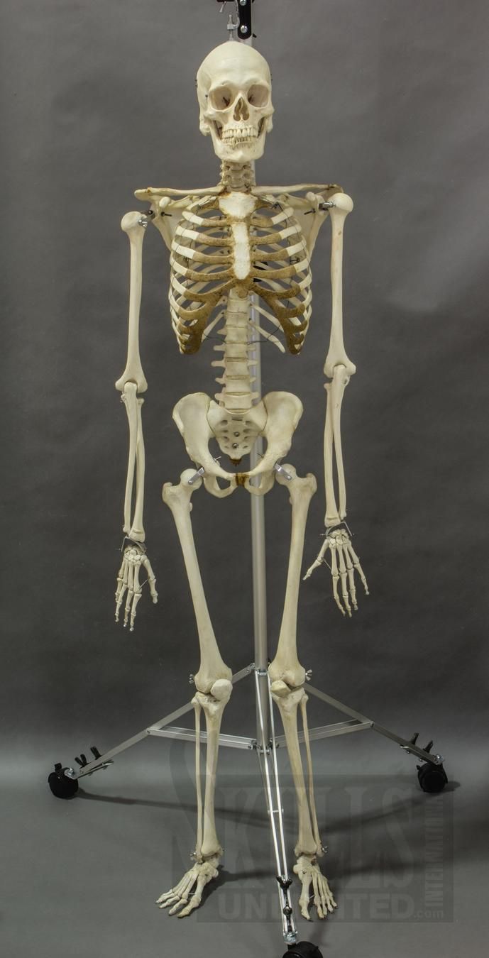 "Hugo",Human,Skeleton