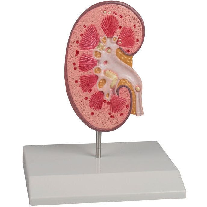 Model,Kidney,Stone